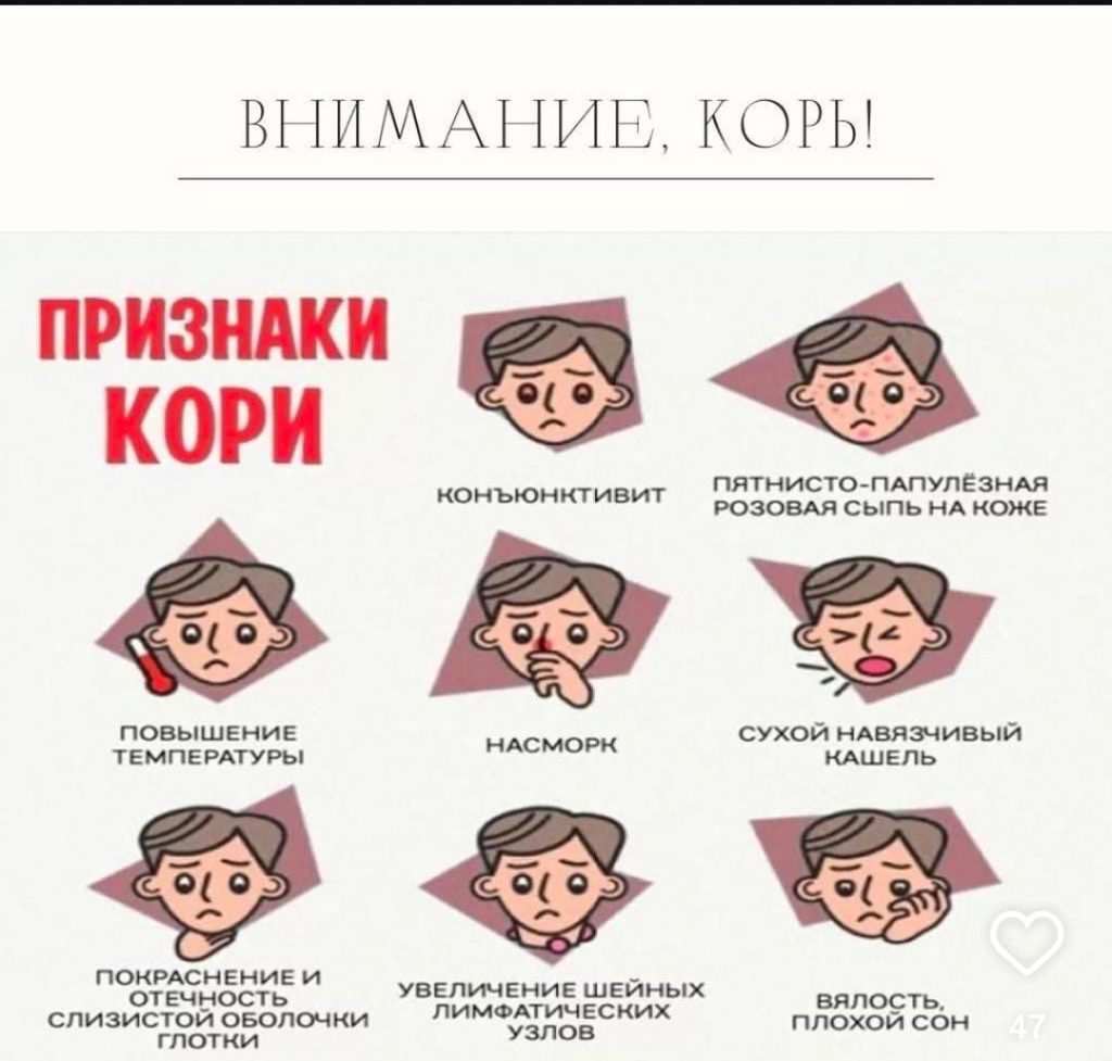 Инфографика с основными признаками кори у детей: сыпь, температура, кашель и конъюнктивит